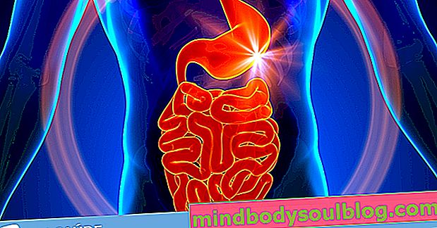 Cancer de l'intestin: qu'est-ce que c'est et principaux symptômes