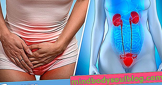 6 symptômes courants d'une infection des voies urinaires