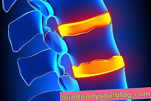 Schmerzen in der Mitte des Rückens: 7 mögliche Ursachen und was zu tun ist