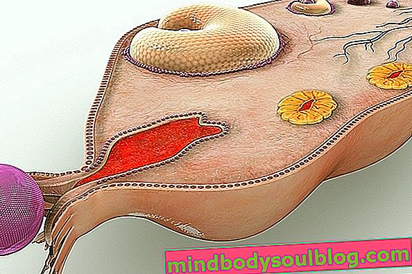 Apa yang bisa menjadi nyeri ovarium dan apa yang harus dilakukan