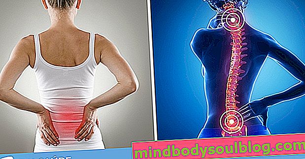 Penyebab paling umum dari nyeri punggung dan perut