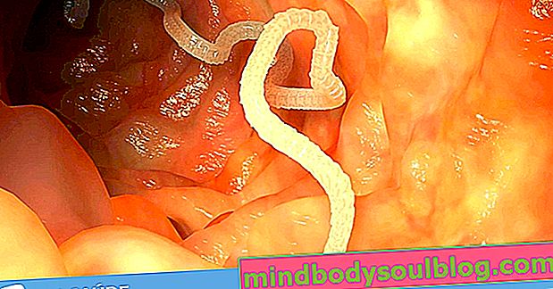 Symptome, die auf Darmwürmer hinweisen können