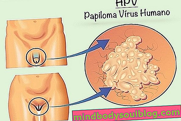 HPV: symptômes, transmission, guérison et traitement