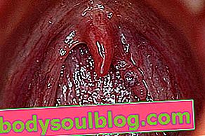 HPV dans la gorge