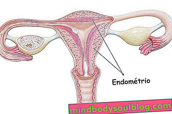 子宮内膜：それが何であるか、それがどこにあるか、そして起こり得る病気