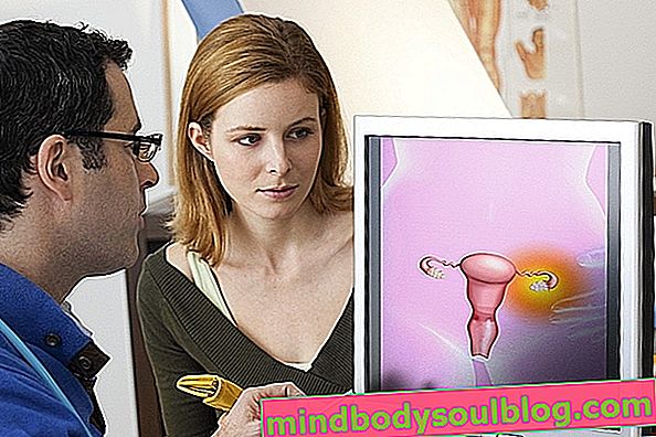 子宮内膜腫：それが何であるか、症状と治療